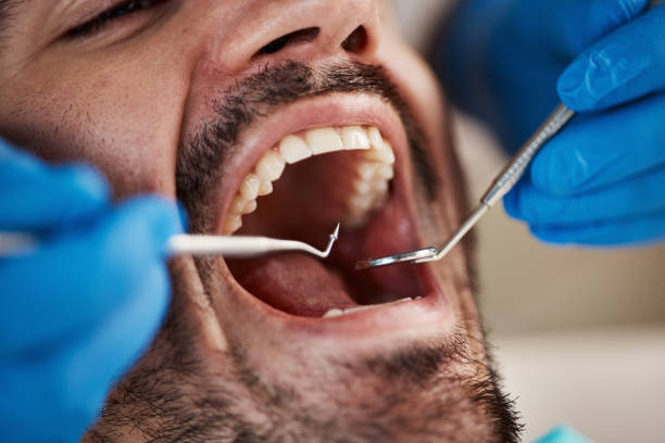 Best Emergency Broken Tooth Repair in Allouez, WI